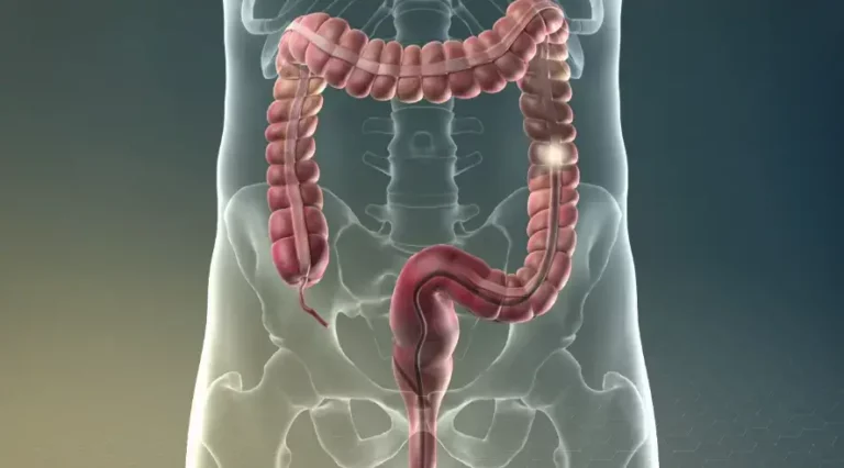 What Occurs During a Colonoscopy Procedure?