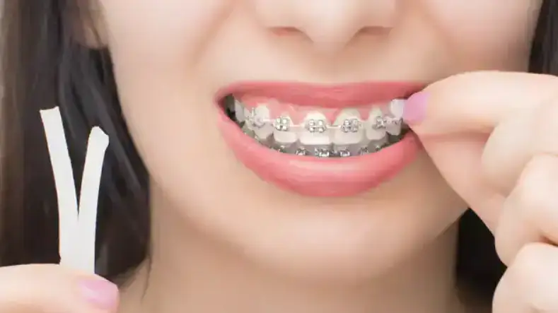 Orthodontic Care