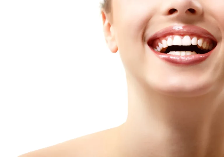 What Are the Common Types of Veneers?